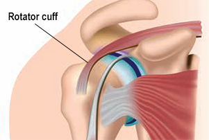 Shoulder diagram