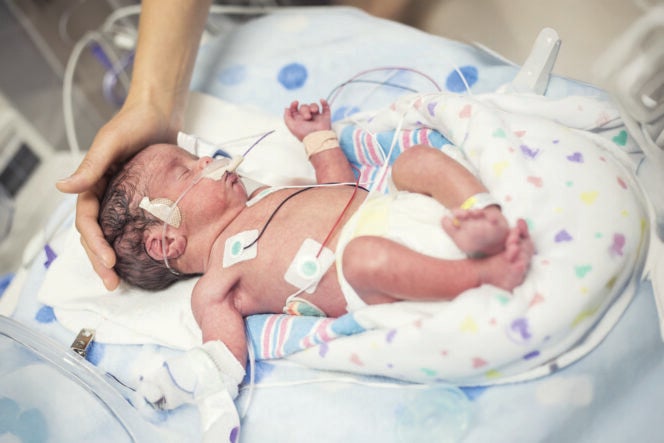 A newborn lays in an incubator with monitor lines and an oxygen tube. A woman's hand rests on the baby's head